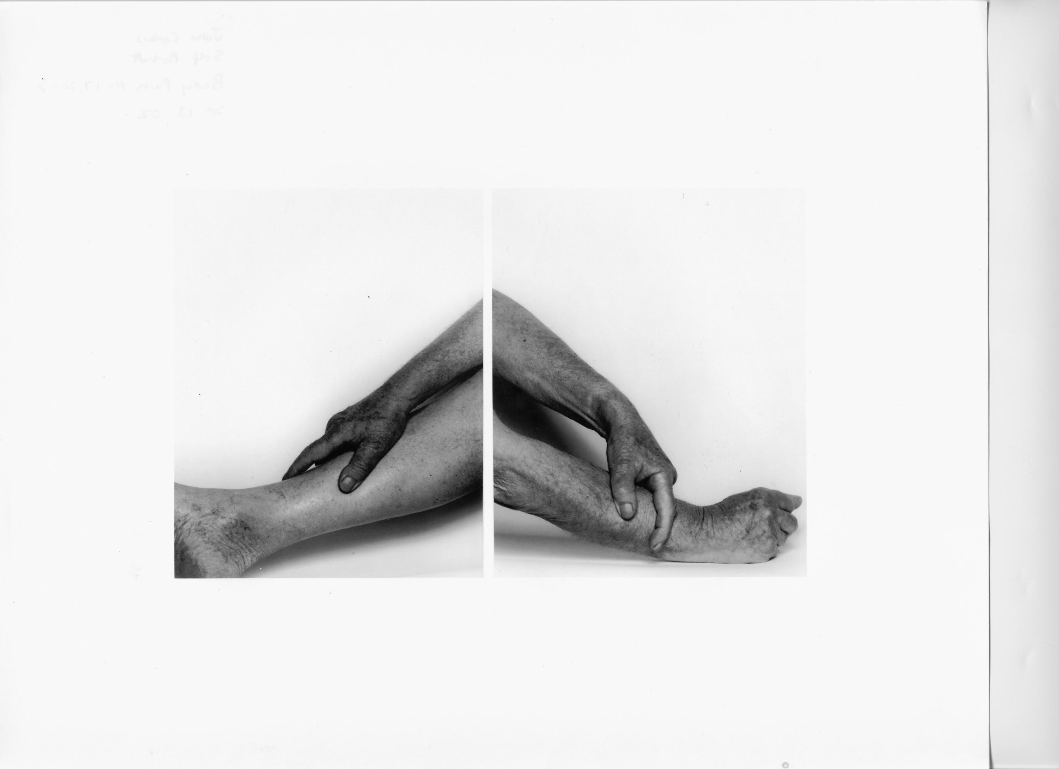 Two black and white photos displayed together of a person’s forearms, hands, leg, facing opposite directions, blending together.