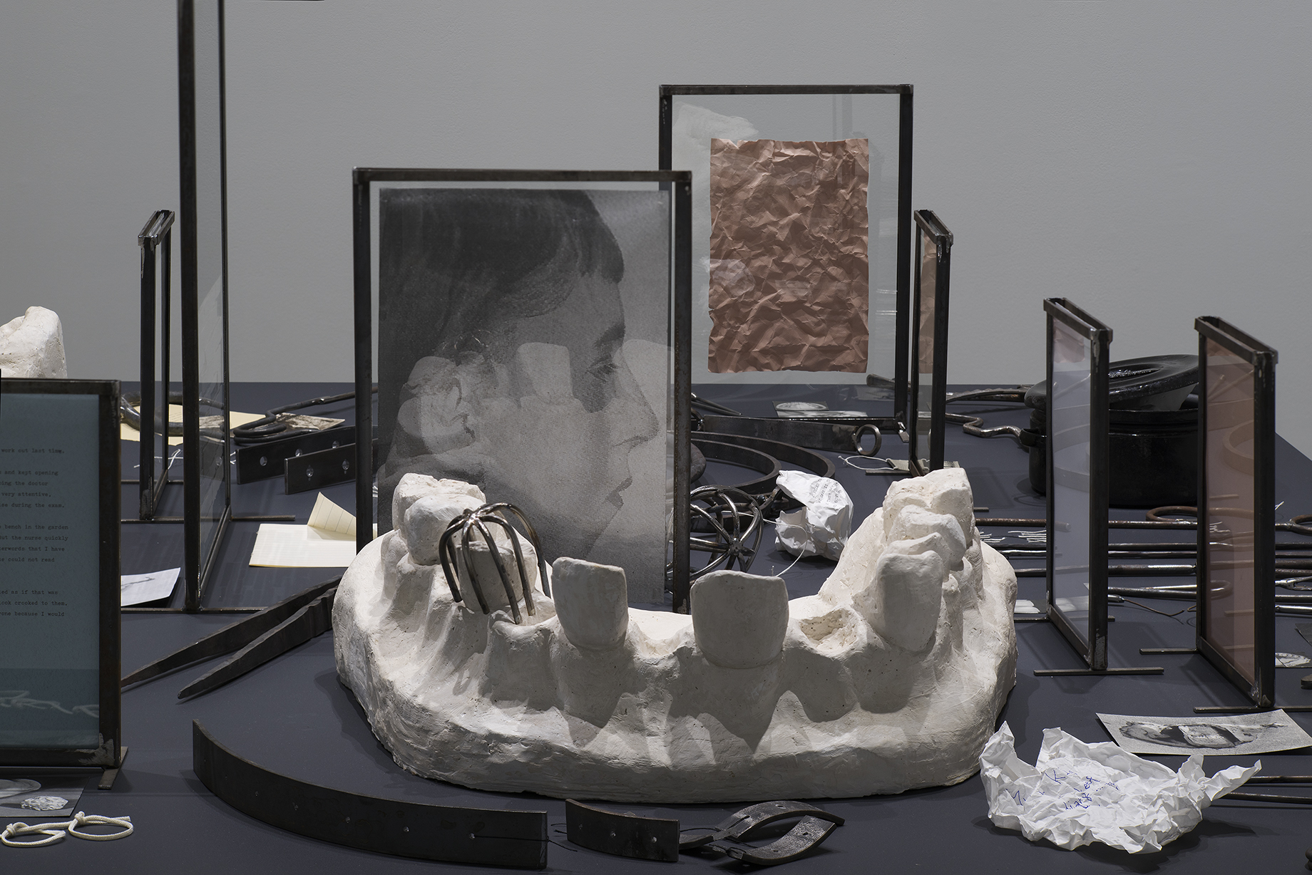 A tabletop holds a variety of items, including metal picture frames, sharp tools, and a large model of a set of lower teeth.