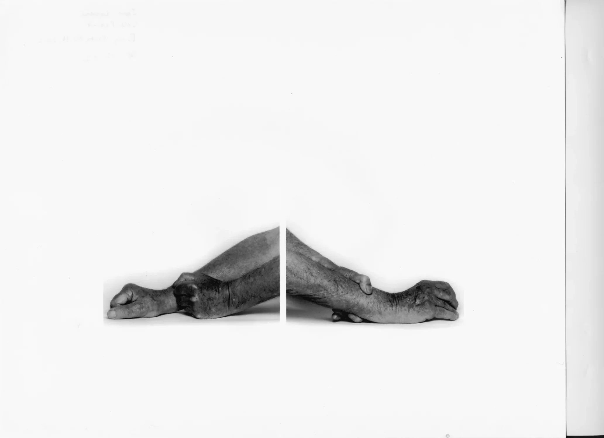 Two black and white photos displayed together of a person’s forearms and hands, facing opposite directions, blend together.