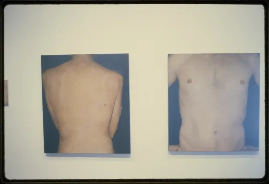 A gallery wall displays two images of a human torso. One shows the back view of a torso while the other shows the front view.