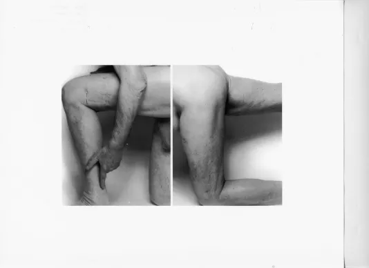 Two intimate black and white photos displayed side by side of a person posing nude on one knee with one arm resting on leg. 