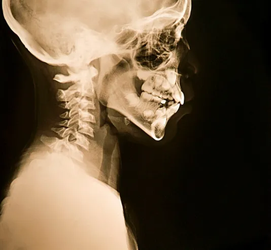 X-ray image of the a human profile from shoulders up