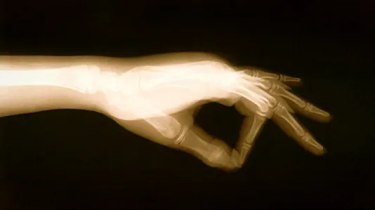 X-ray image of a hand stretching out with the index finger and thumb touching to make an 'O'